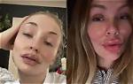 Alyssa Mckay Plastic Surgery Viral on Tiktok: Before and After Photo