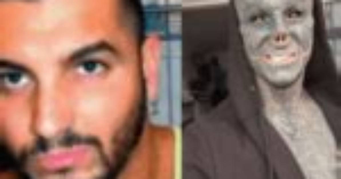 Anthony Loffredo Age Wiki Biography, Instagram: Black Alien Guy Before Transformation