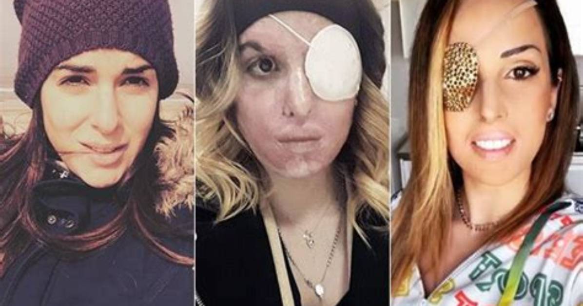 Gessica Notaro Prima Incident Photos: What Happened to Filippo Bologni Moglie? - Sarkariresult
