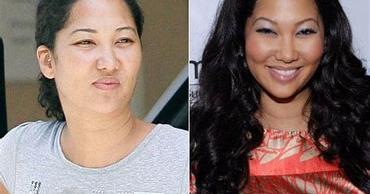 Kim Lee Before and After Plastic Surgery, Who Is Kim Lee?