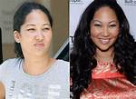 Kim Lee Before and After Plastic Surgery, Who Is Kim Lee?