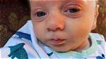 Mom Shares Terrifying Video of Baby Trying to Breathe, Warns of Rsv Symptoms as He Is Hospitalized