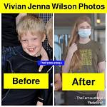 Vivian Jenna Wilson Photos Before and After Surgery on Instagram