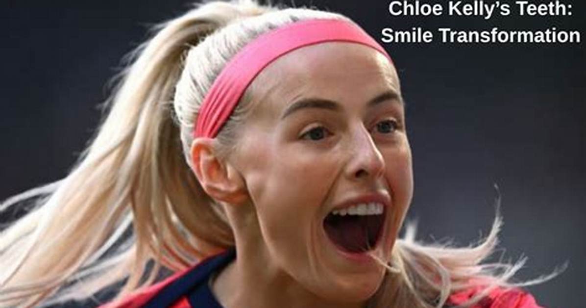 What Is Wrong with Chloe Kelly Teeth? Face and Nose Injury – Does She Use Braces?